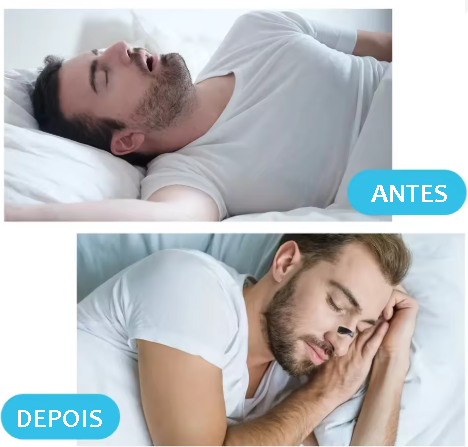 Air Mag - Dilatador Nasal Magnético